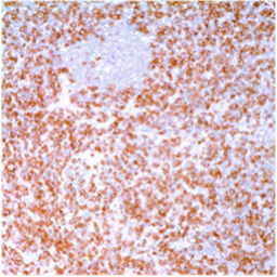 ALK Protein