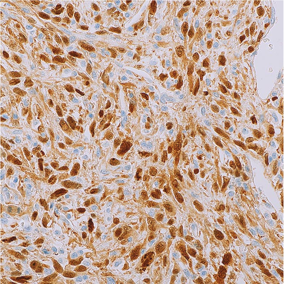 CDK4