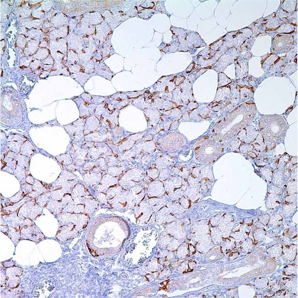 Cytokeratin 14