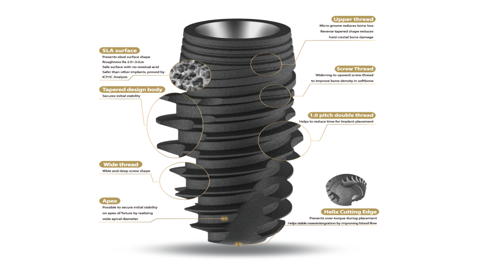 IZEN Implant